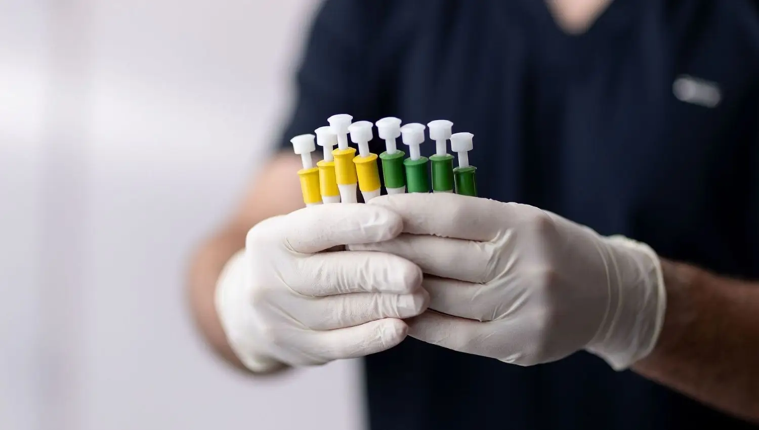 TRANSPLANTE-CAPILAR-DHI