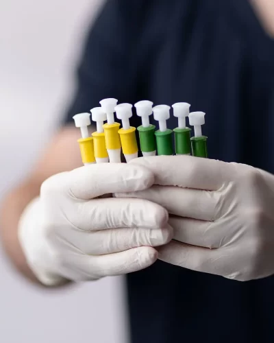 clinica-leopoldo-duailibe-santos-transplante-capilar